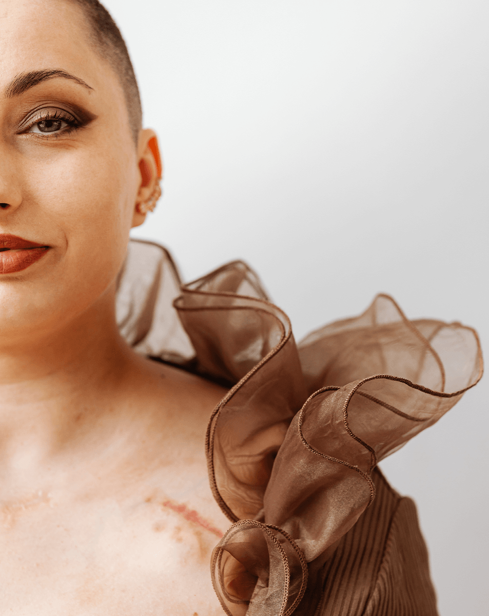 The Best Cocoa Butter for Scars That Actually Heal