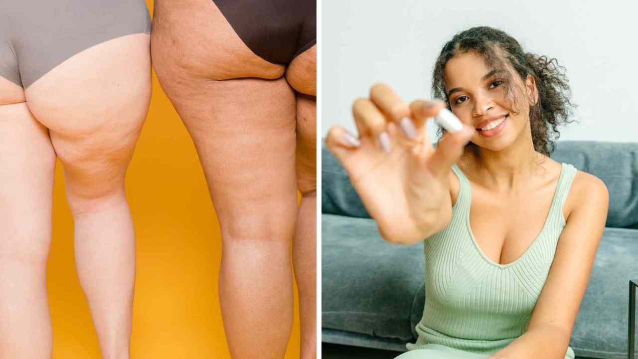 Battling Bum Dimples Does Collagen Help with Cellulite?