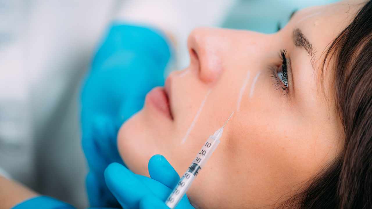 How Long Does Sculptra Last & Will You Need TouchUps?