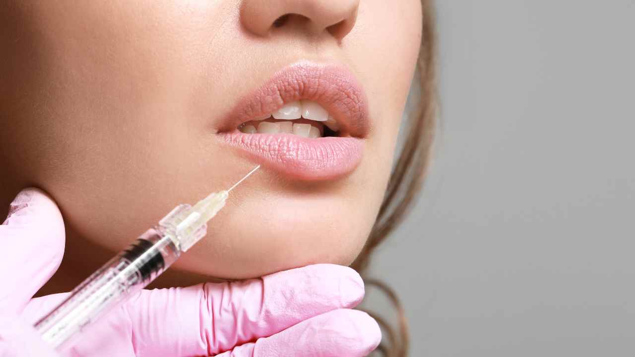 Lip Filler Lifespan How Long Do Lip Injections Last?