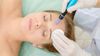 how to treat breakouts after microneedling