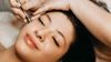 Microdermabrasion for acne scars