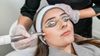 laser treatment for acne