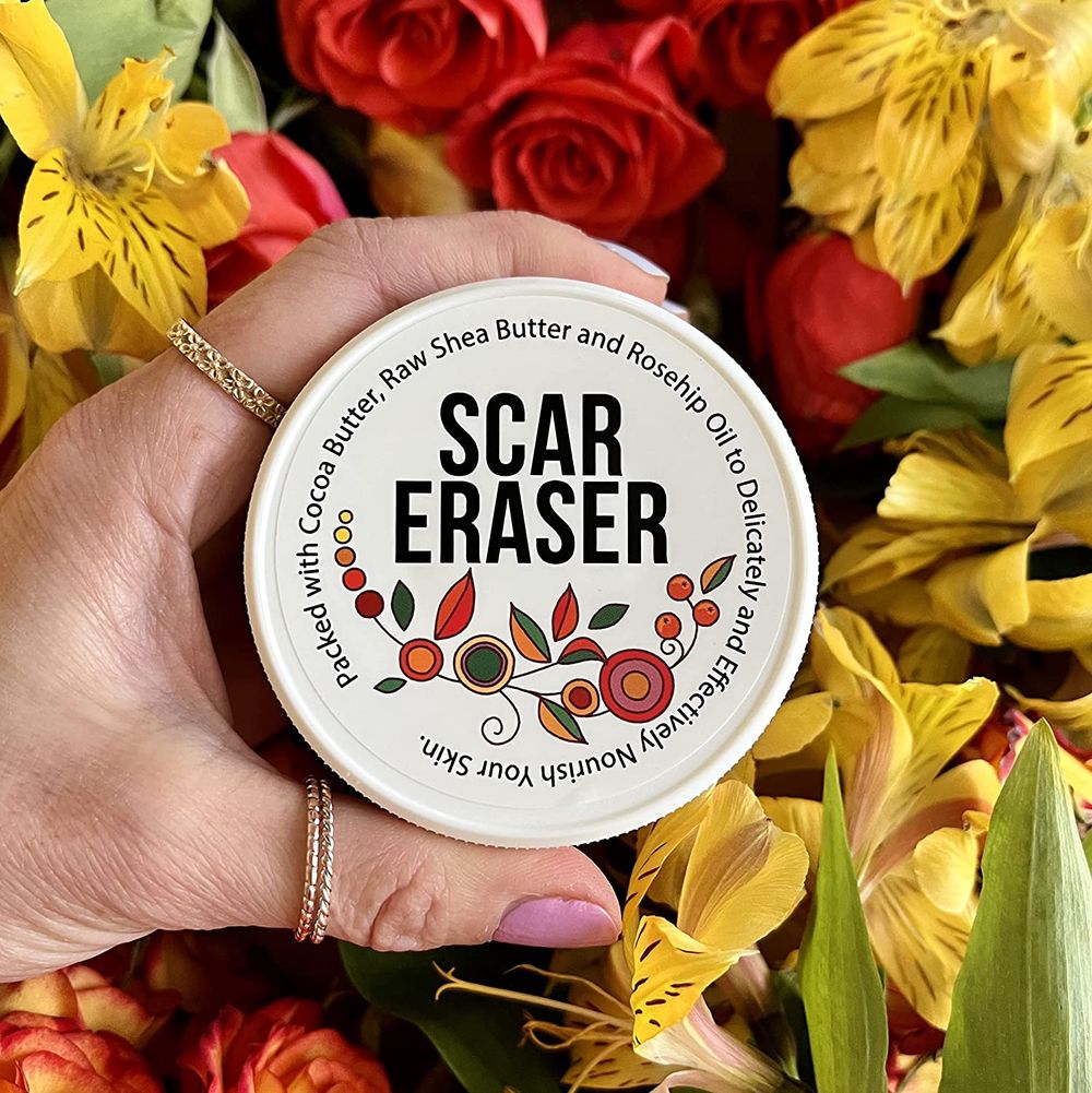 The Best Cocoa Butter for Scars That Actually Heal