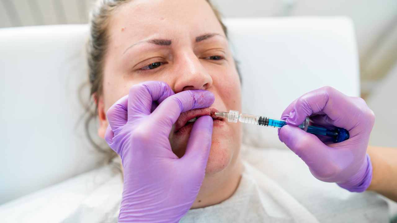 Pucker Up for the Painful Truth Do Lip Injections Hurt?