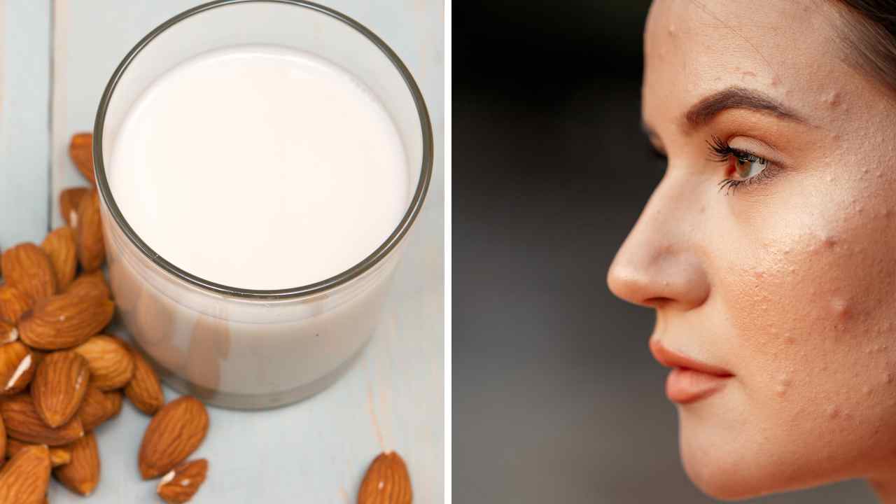 Got Acne? Does Almond Milk Cause Acne or is it a Myth?