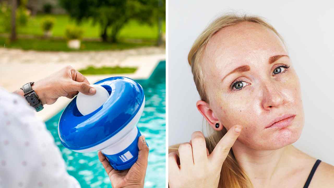 Summer Skincare Secret Does Chlorine Help Acne?