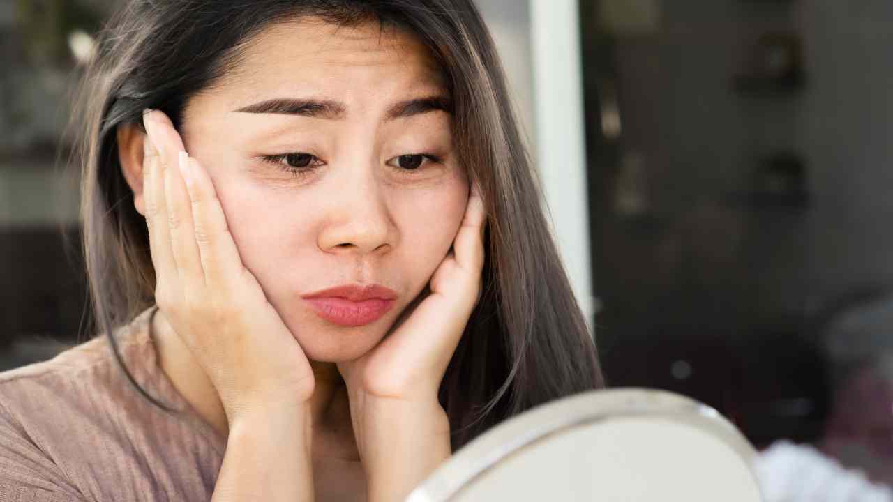 Pimple Panic Does Acne Age Your Skin? The Truth Revealed