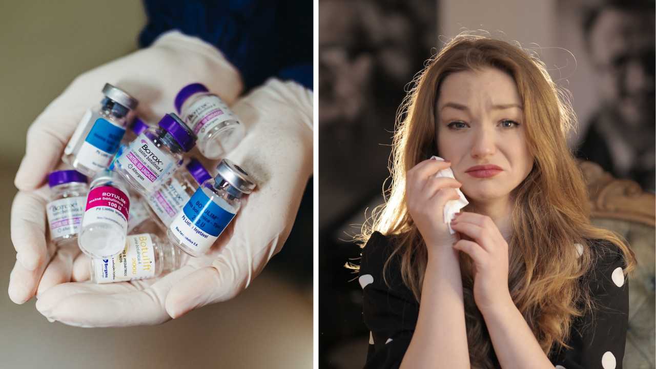 Can Botox Cause Hair Loss