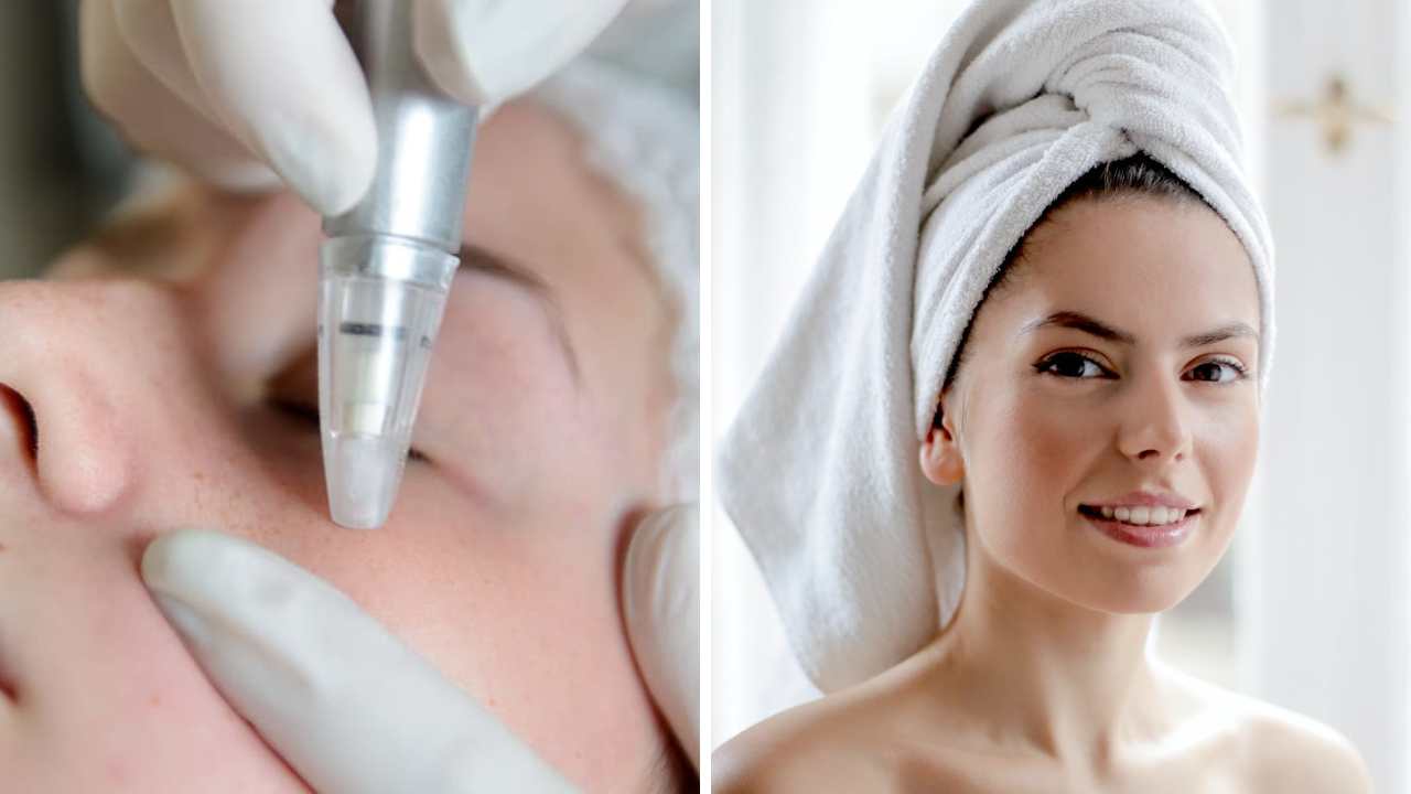 How Long After Microneedling Can I Wear Makeup