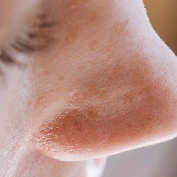 Does Cocoa Butter Clog Pores? Hard Fact or Total Myth?