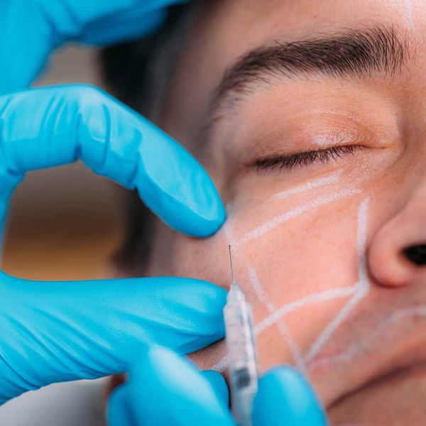 How Long Does Sculptra Last & Will You Need TouchUps?