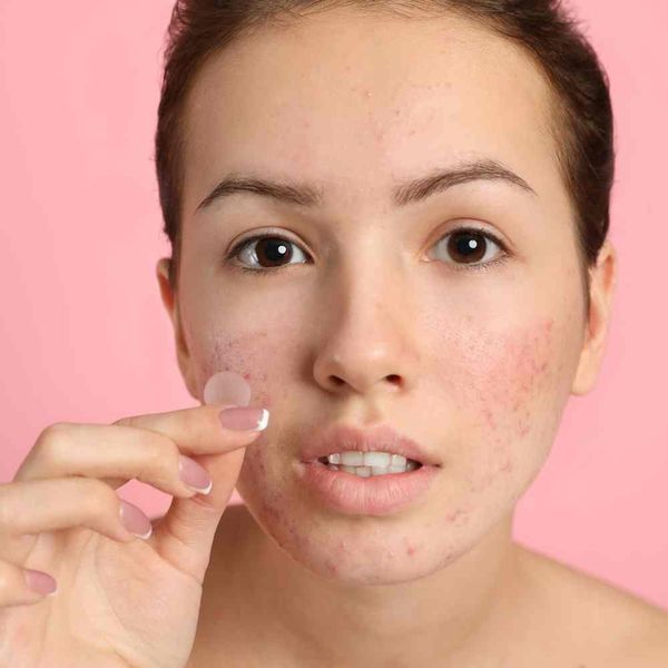 Can You Put Makeup Over a Pimple Patch? Here's the Trick!